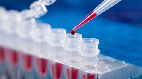 advanced laboratory solutions|advanced lab solutions covid testing.